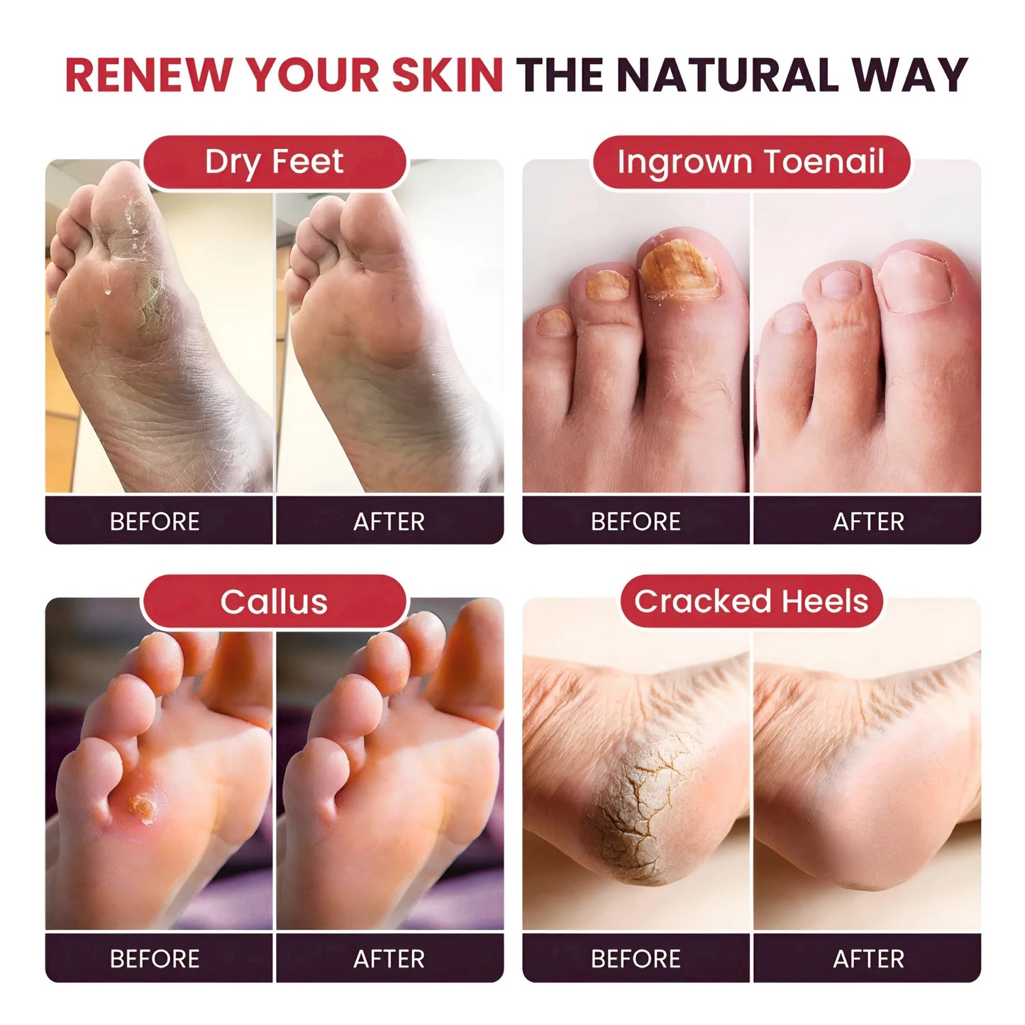 Muscle Relief Foot Soak with Epsom Salts