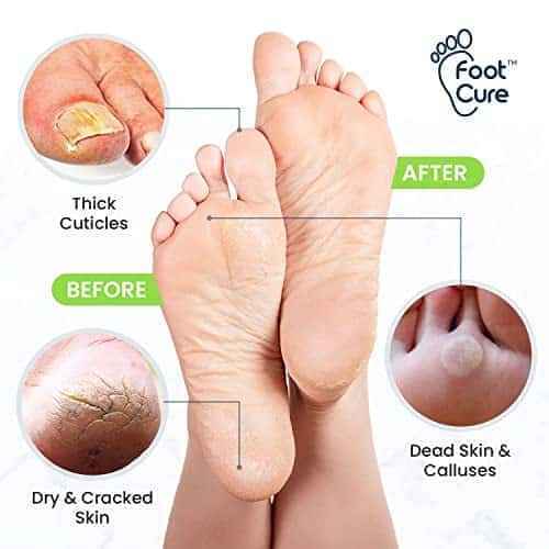 Foot Care Kits
