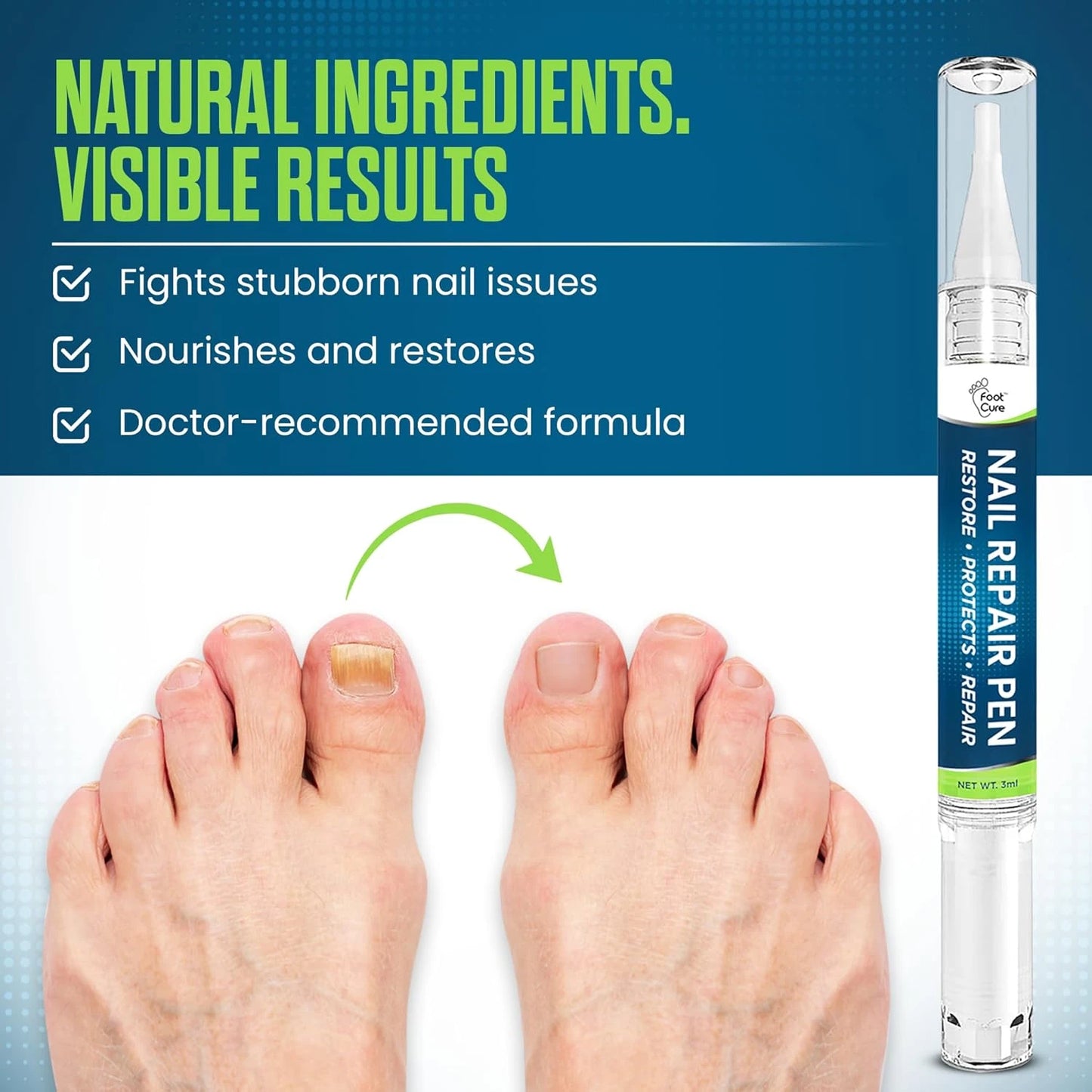 Toenail Fungus Treatment Extra Strength - Pen 4 pack