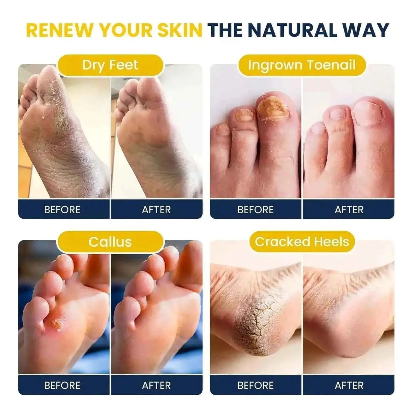Citrus Detox Foot Soak with Epsom Salts - 16oz Foot Cure