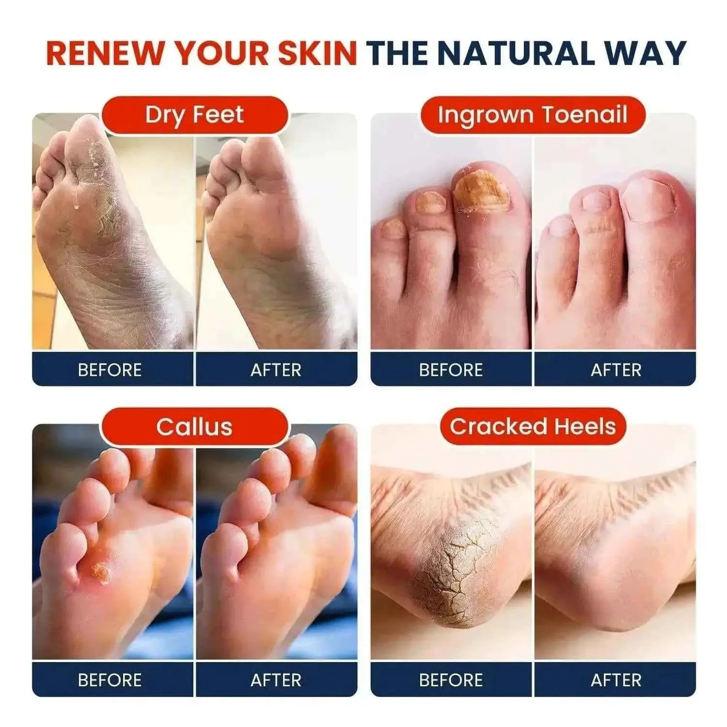 Muscle Relief Foot Soak with Epsom Salts Pack of 2 Foot Cure