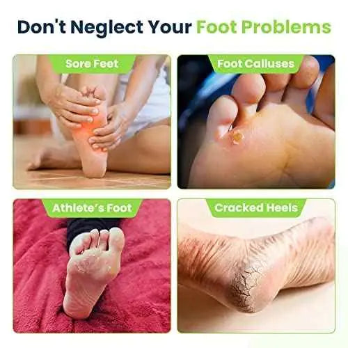 Tea Tree Foot Soak & Callus Remover Gel Kit Foot Cure