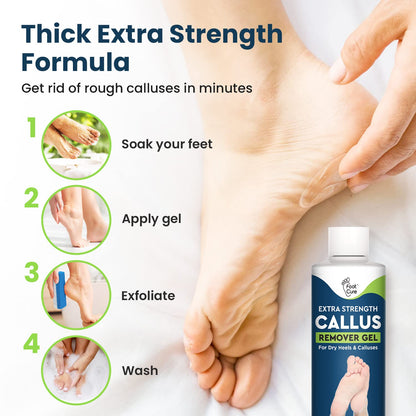 Callus Remover for Feet with Extra Strength Gel & Foot Pumice Stone Set