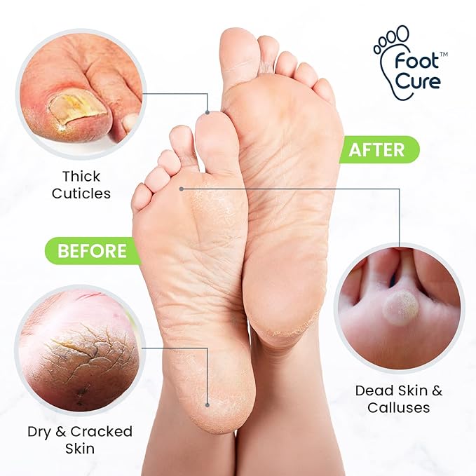 Soak+Balm+Nail Pen 3in1 Combo