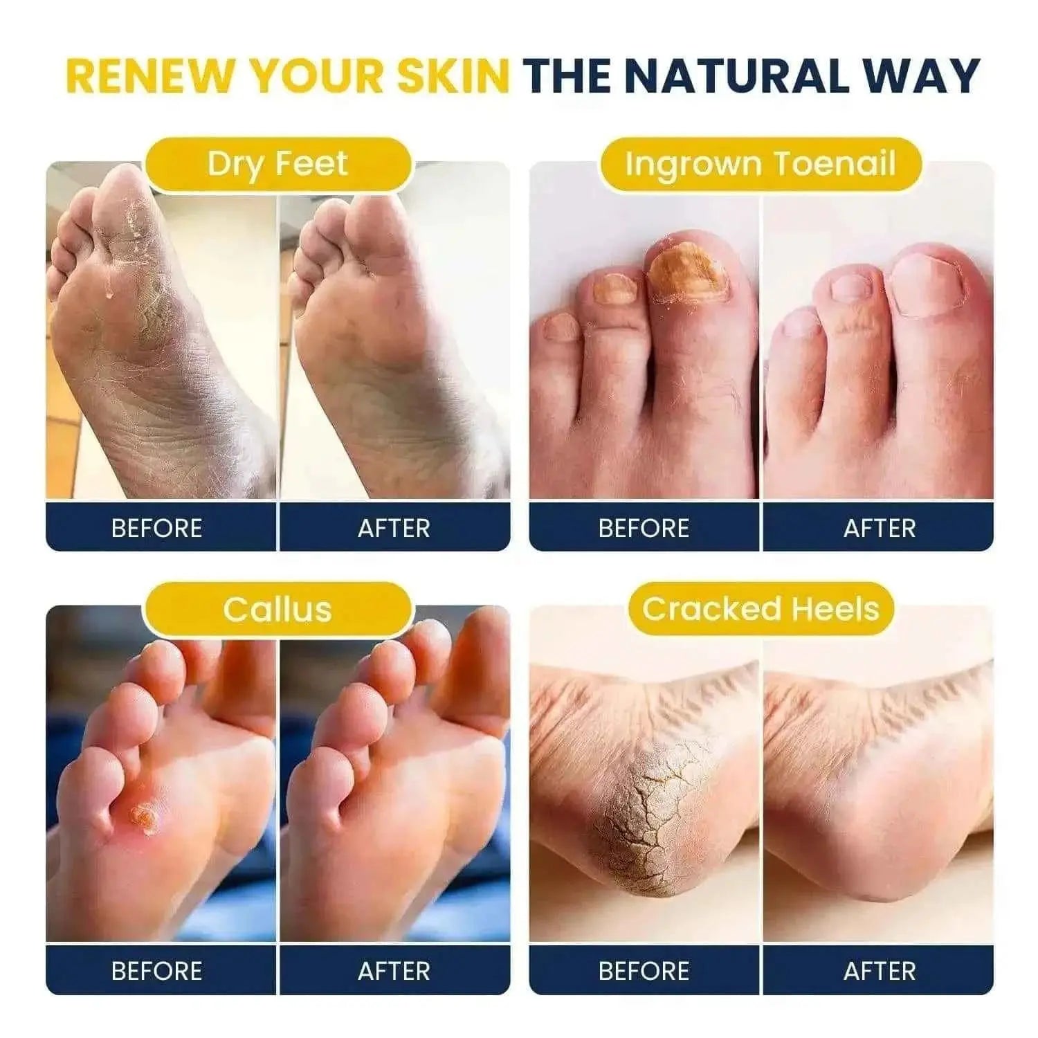 Citrus Detox Foot Soak with Epsom Salts - 16oz Foot Cure