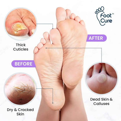 Lavender Foot Soak & Callus Remover Gel Kit Foot Cure