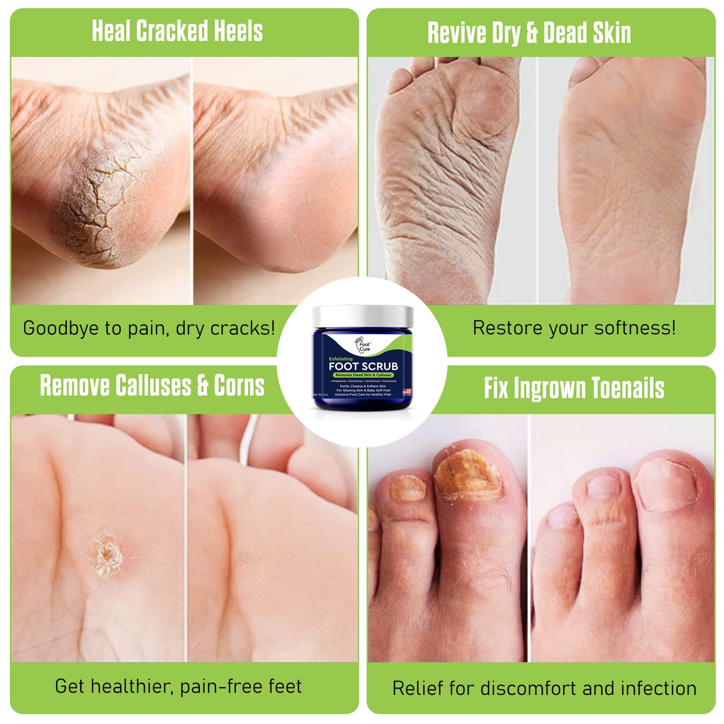 Exfoliating Foot Scrub with Pumice Stone Powder - 2 Pack