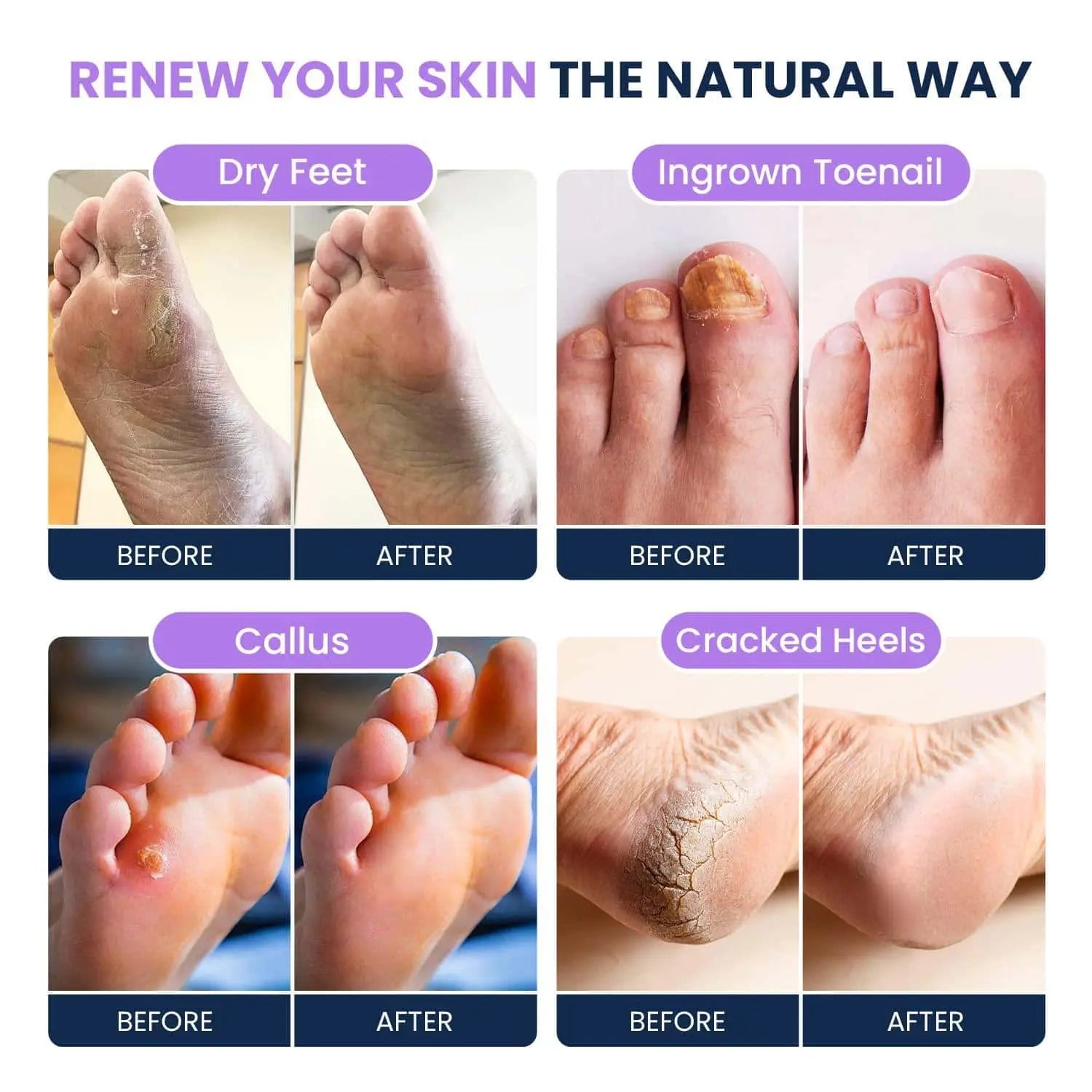 Soothing Lavender Foot Soak with Epsom Salt - Pack of 2 Foot Cure