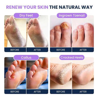 Soothing Lavender Foot Soak with Epsom Salt - Pack of 2 Foot Cure